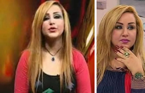 Đặc biệt khi so sánh với nhan sắc thuở chưa phẫu thuật làm đẹp của Dalia, nhiều người thảng thốt vì quá khác biệt, không thể nhận ra. Cũng nhờ diện mạo này, nhiều trang tin nổi tiếng như Dailymail, The Sun, Dailystar đều có bài viết về cô nàng.