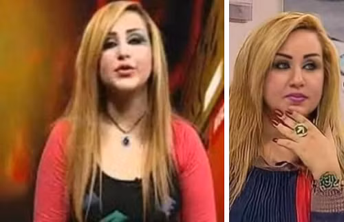 Đặc biệt khi so sánh với nhan sắc thuở chưa phẫu thuật làm đẹp của Dalia, nhiều người thảng thốt vì quá khác biệt, không thể nhận ra. Cũng nhờ diện mạo này, nhiều trang tin nổi tiếng như Dailymail, The Sun, Dailystar đều có bài viết về cô nàng.