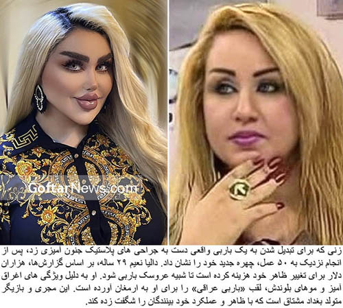 Chiếc mũi siêu nhỏ, hàng lông mày rộng, mặt to và đôi môi căng bóng khiến Dalia ngày càng tiệm cận với hình ảnh “Búp bê Barbie của Iraq”. Thế nhưng, diện mạo mới của cô cũng có chút “dọa người”.