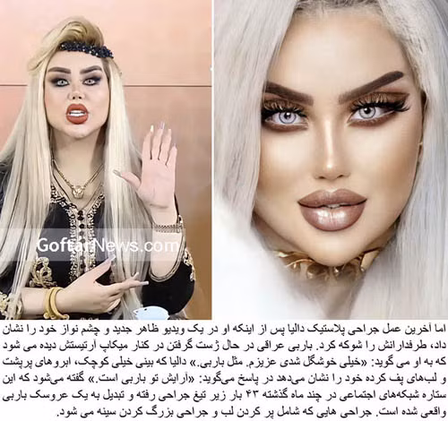 Dalia rất biết tận hưởng diện mạo mới của mình. Cô nàng thường xuyên đăng tải hình ảnh chụp cận mặt lên trang Instagram hơn 996.000 người theo dõi. Mỗi bức ảnh cô chia sẻ đều thu hút lượng lớn người chú ý, bình luận.