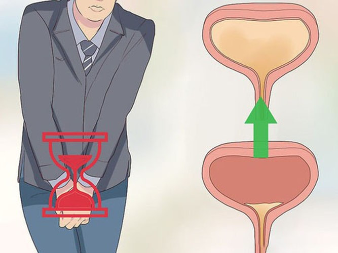 Theo bác sĩ, nhịn tiểu lâu ngày dẫn đến tổn thương thận. Nhịn tiểu cũng tạo cơ hội cho vi khuẩn, vi rút phát triển mạnh trong nước tiểu. Nước tiểu không thải ra ngoài kịp thời sẽ chảy ngược vào tuyến tiền liệt, gây viêm.