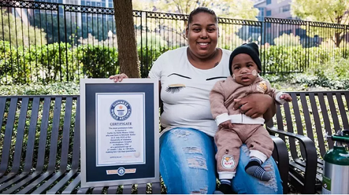 4. Em bé sinh non nhất. Kỷ lục em bé sinh non nhất thuộc về Curtis Means. Cậu được sinh ra chỉ sau 21 tuần thai, nặng 420g. Thời điểm Curtis chào đời, các chuyên gia tiên lượng cậu chỉ có 1% cơ hội sống sót và phép màu đã xảy ra. Tới nay cậu bé gần 3 tuổi, chịu một số biến chứng sức khỏe do sinh sớm như huyết áp cao.