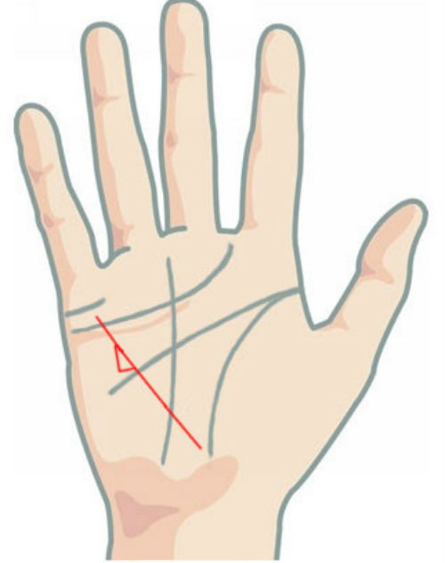 Trong khi đó, hình tam giác xuất hiện trên đường sức khỏe cho biết chủ nhân gặp vấn đề về sức khỏe tâm thần.