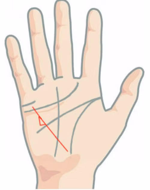 Trong khi đó, hình tam giác xuất hiện trên đường sức khỏe cho biết chủ nhân gặp vấn đề về sức khỏe tâm thần.