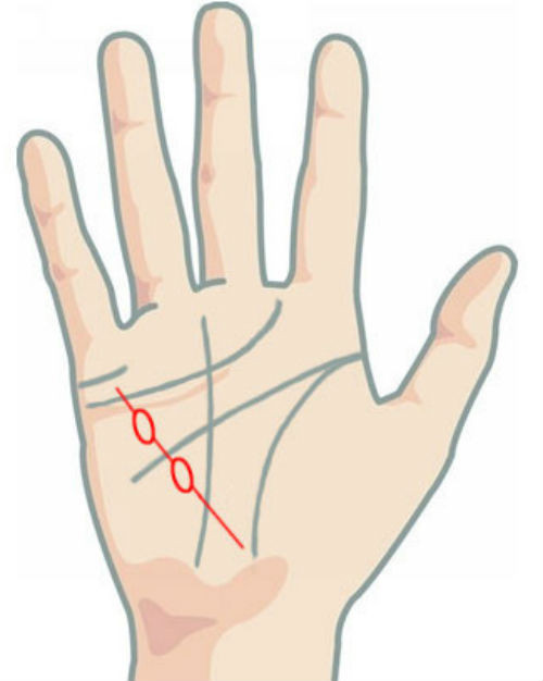 Những hình mắt xích lớn rất có thể là biểu hiện của bệnh tăng sản tuyến vú ở phụ nữ.