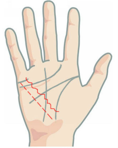 Nếu đường chỉ tay sức khỏe hình gợn sóng hoặc đứt đoạn thì có thể chủ nhân đang gặp vấn đề về tiêu hóa, chức năng gan suy giảm.