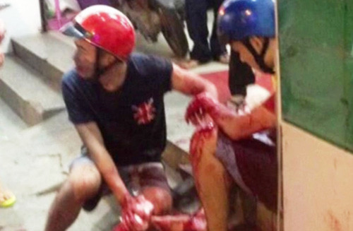 Một trong số 2 nạn nhân bị cướp đâm trọng thương.