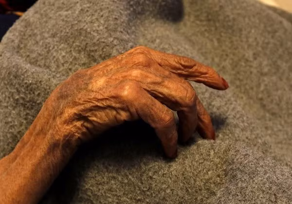 Được biết, Liên Hợp Quốc đang triển khai những đội phản ứng nhanh để đi đến từng nhà hướng dẫn người dân cách tự bảo vệ sức khỏe qua việc làm sạch và lưu trữ nước uống. Ảnh: FNA.