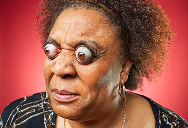 Bà Kim Goodman có thể làm mắt lồi ra khỏi hốc mắt tới 12 mm. Ảnh: PL.