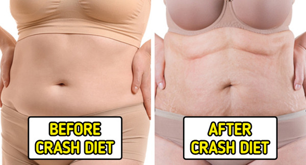 5. Áp dụng chế độ ăn kiêng cực đoan. Ăn kiêng thời gian ngắn hỗ trợ giảm cân. Vậy nhưng, ăn kiêng thời gian dài không tốt cho sức khỏe. (Ảnh: Brightside)