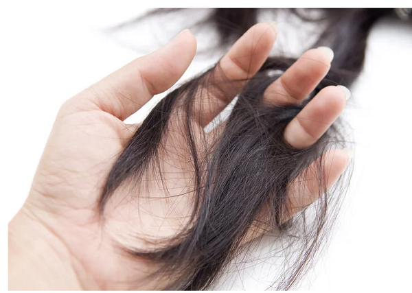 Rụng tóc. Rụng tóc cũng là dấu hiệu phổ biến của thiếu hụt vitamin B7. Được biết, vitamin B7 là một thành phần nhỏ trong tóc, góp phần duy trì sự tăng trưởng và phát triển bình thường của tóc. Thiếu vitamin B7 dẫn đến rối loạn chức năng thần kinh, rụng tóc, gàu và bạc tóc ở tuổi thiếu niên. (Ảnh: Aboluowang)