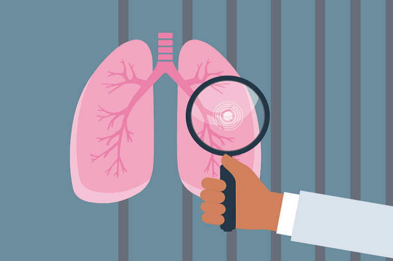 Một khi ung thư phổi gây di căn não thì căn bệnh có khả năng đã ở giai đoạn cuối do khu vực di căn ở xa. Đa số bệnh nhân bị di căn ở não chỉ được phát hiện khi có những biểu hiện rõ ràng. Lúc này, việc điều trị sẽ rất khó khăn. (Ảnh: clevelandclinic)