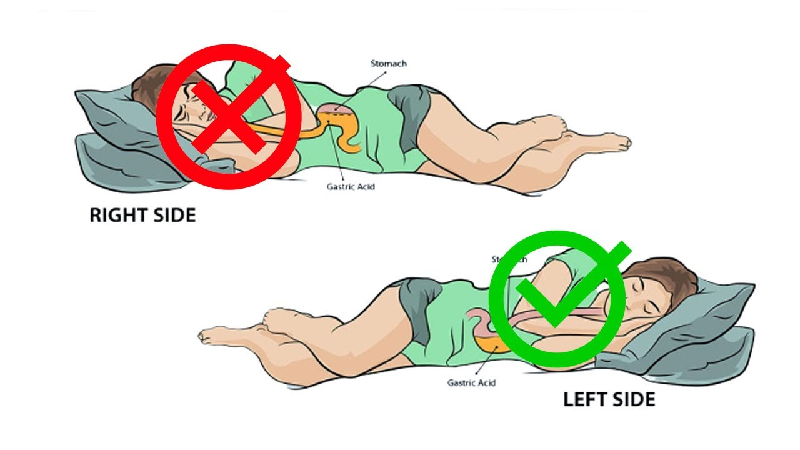 4. Chú ý đến tư thế cơ thể. Trào ngược dạ dày - thực quản có thể xảy ra khi cơ thể gập người, cúi xuống, cúi đầu, nằm ngửa,… Nếu thường xuyên bị trào ngược vào ban đêm, bạn có thể kê cao đầu giường tối thiểu 15cm, tốt hơn là ngủ nghiêng về bên trái. (Ảnh: Internet)