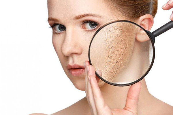 Vậy nhưng, bác sĩ da liễu Zheng Renrong tại Bệnh viện trực thuộc Đại học Tôn Trung Sơn, Trung Quốc chỉ ra, làm sạch quá mức có thể dễ gây kích ứng da, phù nề, nổi mẩn và dễ bị mụn trứng cá, bệnh rosacea. (Ảnh minh họa)