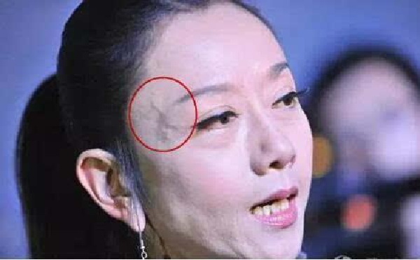 Noi gan xanh o 3 bo phan nay, kham ngay keo hoi khong kip-Hinh-2