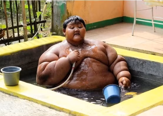 Bi kich cua cau be 12 tuoi nang 200kg bi ep an de mum mim-Hinh-3