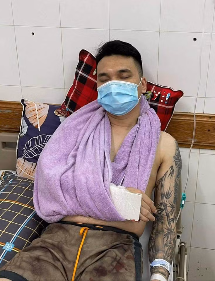 Trước đó, ngày 20/4, Khắc Việt gặp chấn thương trong lúc thi đấu tập luyện thể thao. Nam ca sĩ bị gãy xương cổ tay phải.