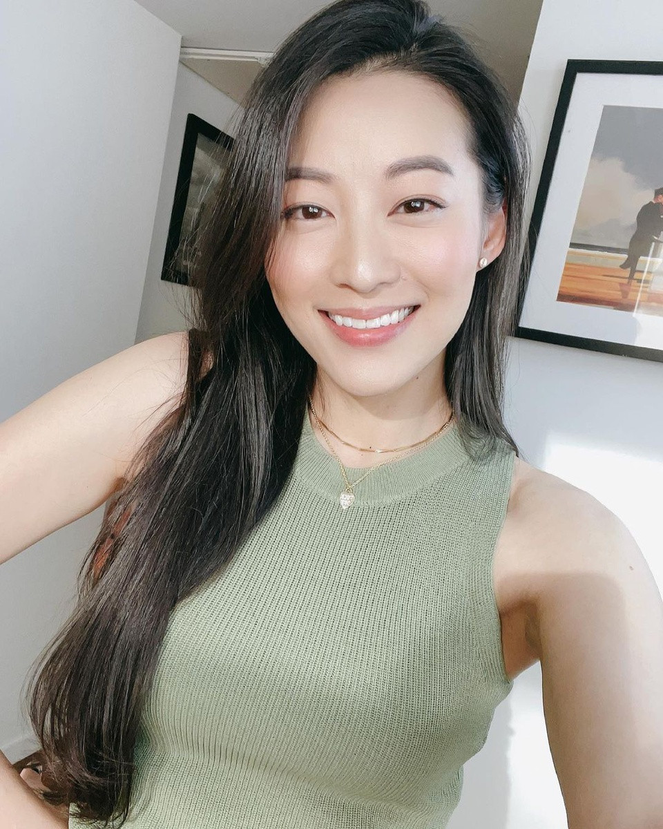 Trong một bài phỏng vấn, người đẹp kể: "Khi còn nhỏ, tôi thường xuyên bị bắt nạt và phải nhập viện hai lần vì bị thương. Tôi bị gãy hai chiếc răng, một chiếc bị sứt mẻ. Toàn bộ khuôn mặt của tôi đã đều có dấu vết. Tôi phải mất đến 6 tháng để hồi phục hoàn toàn". Ảnh: Instagram.