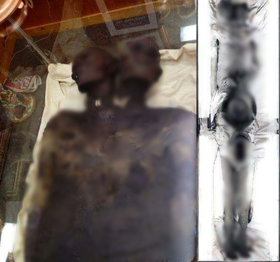 Trong đó, vào năm 1900, xác ướp người khổng lồ 2 đầu Kap Dwa có mặt tại bến tàu Birnbeck ở Weston và được trưng bày trong suốt 45 năm.