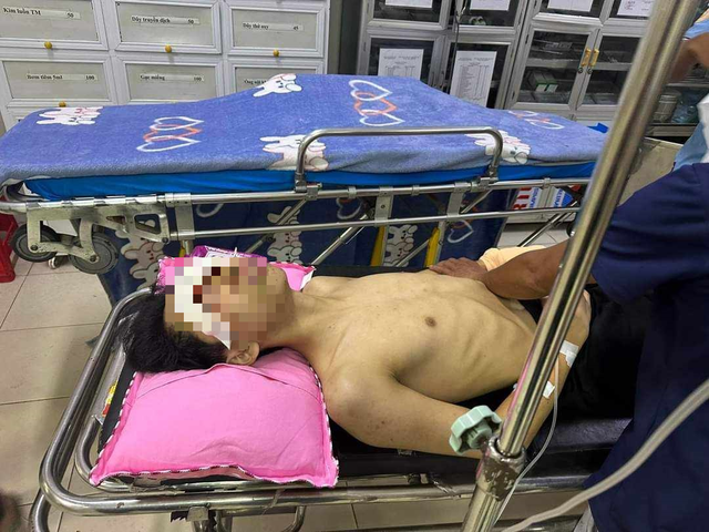  Nam sinh lớp 11 bị thương nghi do nổ bình gas mini: Ngày 1/8, người dân ở thôn 3 (xã Phúc Đồng, huyện Hương Khê, Hà Tĩnh) bất ngờ nghe tiếng nổ phát ra từ nhà của gia đình em Võ Tuấn T. (17 tuổi, ngụ tại thôn 3, xã Phúc Đồng; vừa học xong lớp 11 Trường THPT Hàm Nghi, huyện Hương Khê). Khi đến nơi, người dân phát hiện em T. bị dập nát bàn tay trái, 2 mắt bị tổn thương nặng và đang kêu cứu tại khu vực nhà bếp. Nguyên nhân ban đầu được xác định có thể là do bình gas mini phát nổ trong lúc em này nấu ăn. 