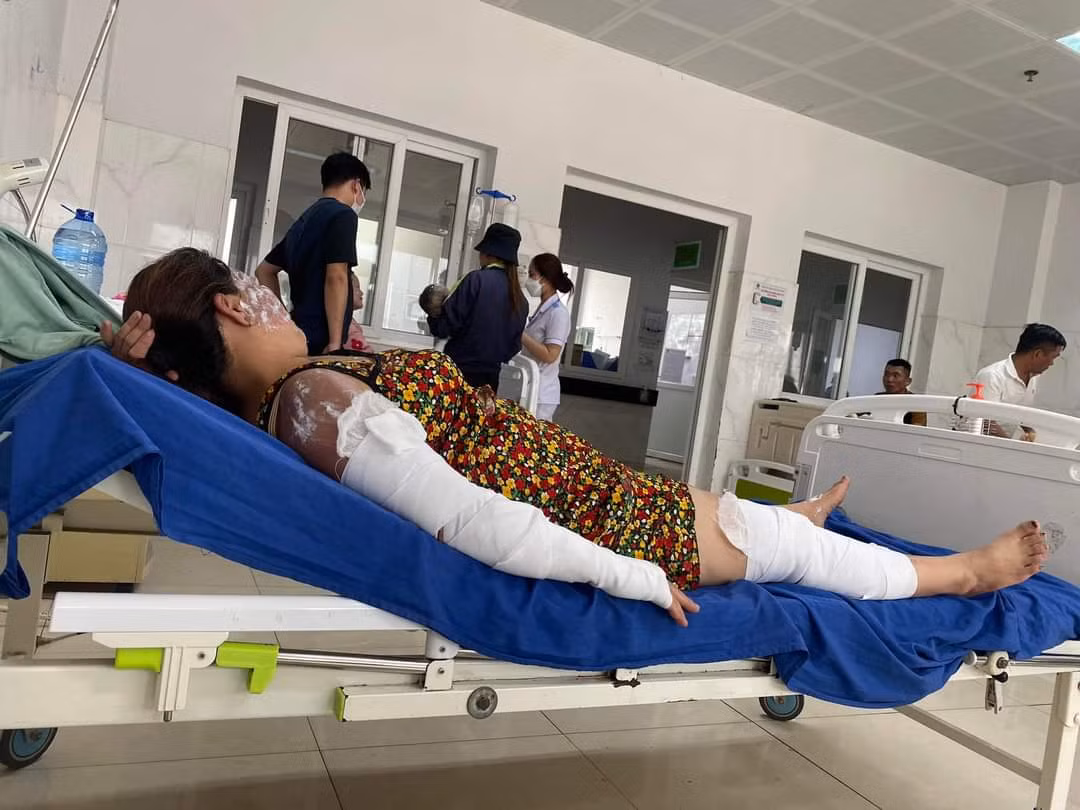  Nổ bình gas mini, 7 người nhập viện: Trưa 9/4, một gia đình ở thôn 2 (xã Ea Tiêu, huyện Cư Kuin, tỉnh Đắk Lắk) tổ chức ăn uống với khoảng 20 người tham dự. Đến khoảng 12h30, khi đang nấu lẩu thì 1 bình gas mini bất ngờ phát nổ khiến ngọn lửa bùng cháy. Vụ nổ khiến 7 người (trong đó có một cháu nhỏ) bị bỏng nhiều nơi trên cơ thể.