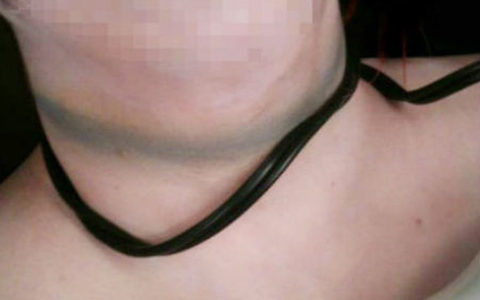 Tiếp nhận tin báo, Công an quận Hà Đông phối hợp cùng các phòng ban nghiệp vụ Công an TP. Hà Nội khẩn trương tiếp cận hiện trường để phối hợp điều tra. Kết quả khám nghiệm tử thi, bước đầu cơ quan điều tra nhận định, nạn nhân tử vong do bị siết cổ. (Ảnh minh họa, nguồn Internet)