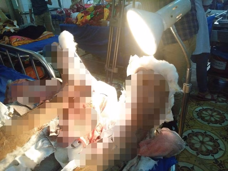 Mau thuan tai quan karaoke, thanh nien bi chem lia chan