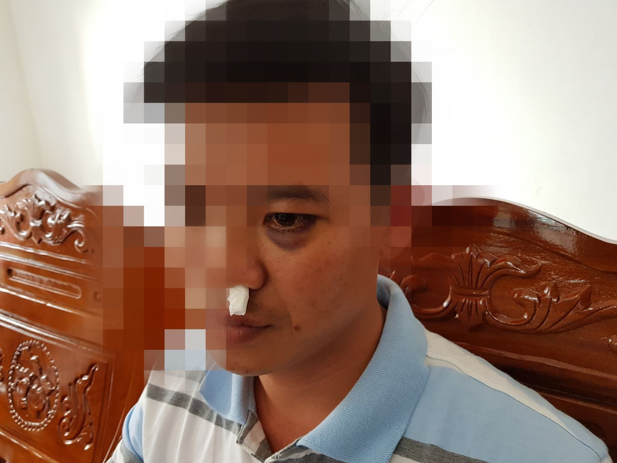 Tiet lo nguyen nhan hoc sinh dan nguoi vao truong danh thay giao