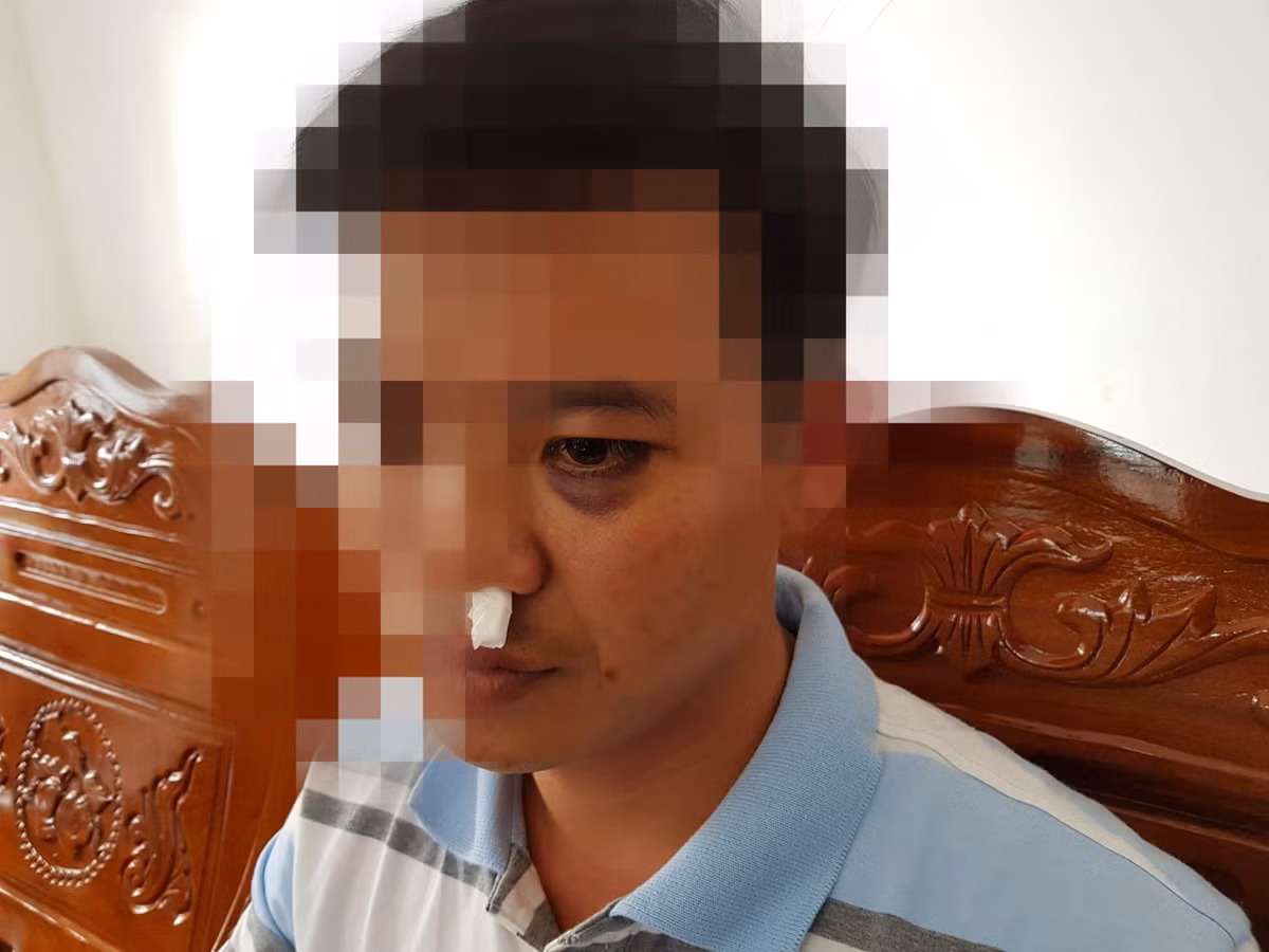 Tiet lo nguyen nhan hoc sinh dan nguoi vao truong danh thay giao