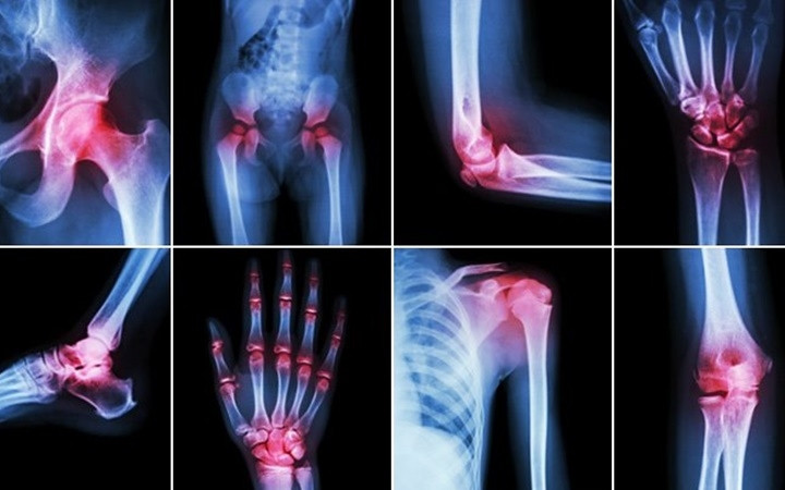 10 căn bệnh của mùa Đông mà ai cũng có thể mắc phải - Hình 6 10 can benh cua mua Dong ma ai cung co the mac phai-Hinh-6