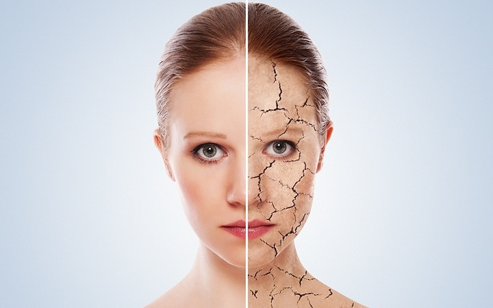 10 căn bệnh của mùa Đông mà ai cũng có thể mắc phải - Hình 10 10 can benh cua mua Dong ma ai cung co the mac phai-Hinh-10