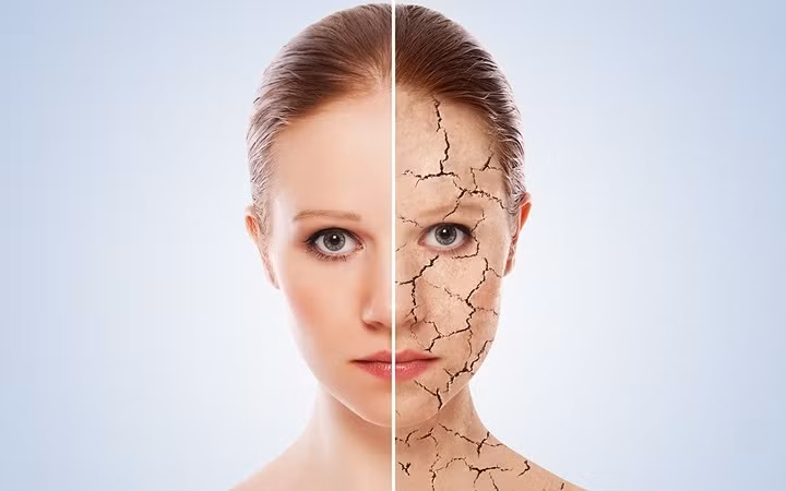 10 can benh cua mua Dong ma ai cung co the mac phai-Hinh-10