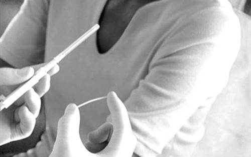 Tác dụng phụ của que tránh thai được ghi nhận là có khoảng 12% trường hợp vô kinh, 24% rong kinh, hơn 3% cảm thấy đau đầu, khoảng 4% bị mụn trứng cá... Một số phản ứng phụ là tăng cân nhẹ, căng tức ngực, cảm giác khô âm đạo. Bạn chỉ cần ngưng sử dụng là có thể mang thai bình thường. Tuy nhiên, nên đợi khoảng 3 tháng để cơ thể ổn định.