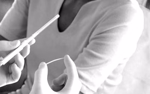 Tác dụng phụ của que tránh thai được ghi nhận là có khoảng 12% trường hợp vô kinh, 24% rong kinh, hơn 3% cảm thấy đau đầu, khoảng 4% bị mụn trứng cá... Một số phản ứng phụ là tăng cân nhẹ, căng tức ngực, cảm giác khô âm đạo. Bạn chỉ cần ngưng sử dụng là có thể mang thai bình thường. Tuy nhiên, nên đợi khoảng 3 tháng để cơ thể ổn định.