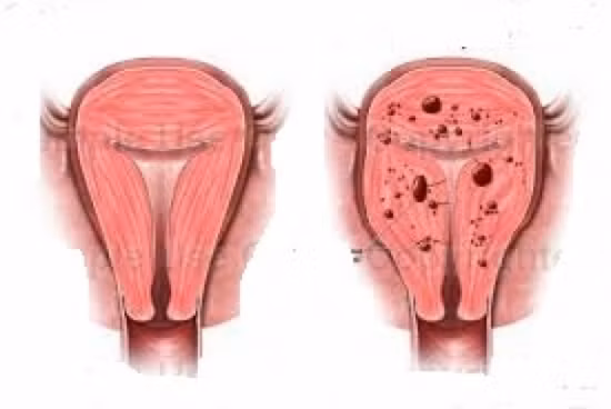 Phan biet lac noi mac tu cung voi dau bung kinh-Hinh-2