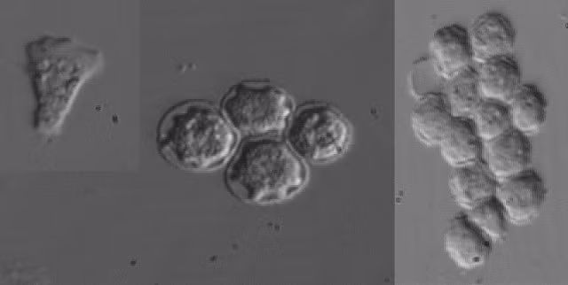 Viêm giác mạc do Acanthamoeba do amip gây ra. Chúng sống tự do trong đất, nước, bụi, bể bơi, ống nước nóng, trong nước biển hay thậm chí cả nước đun sôi. Viêm giác mạc do Ancanthamoeba có thể gặp ở những người khoẻ mạnh, trẻ và có khả năng miễn dịch tốt, đặc biệt hay gặp ở những người đeo kính tiếp xúc. Các yếu tố thuận lợi thường xuất hiện ở những bệnh nhân viêm giác mạc do Ancanthamoe như chấn thương trên giác mạc, đeo kính tiếp xúc, dùng nước bẩn.