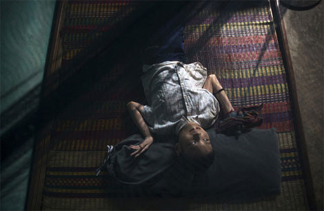 Không thể xác định được bao nhiêu thế hệ người Việt Nam bị rối loạn di truyền vì chất độc da cam.