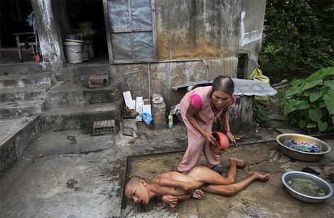 Mỹ bắt đầu sử dụng chất độc da cam từ năm 1961 để phá hủy những khu rừng - nơi ẩn náu của quân du kích.