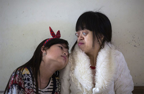 Tại các khu vực bị ảnh hưởng, nguy cơ dị tật về thể chất là cao hơn mức bình thường ba lần.