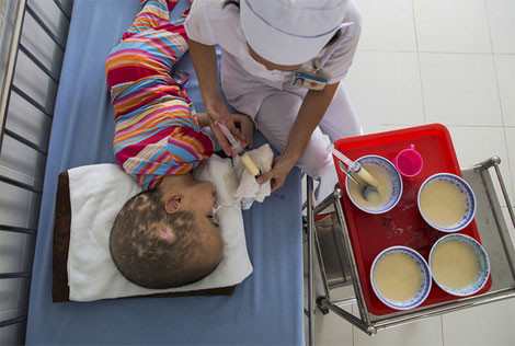 Có nhiều trẻ em, khi sinh ra thì khỏe mạnh. Nhưng sau đó phát triển trì trệ và trở thành tàn tật.