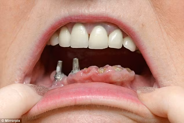 Di chũa rang, bác sĩ cho 