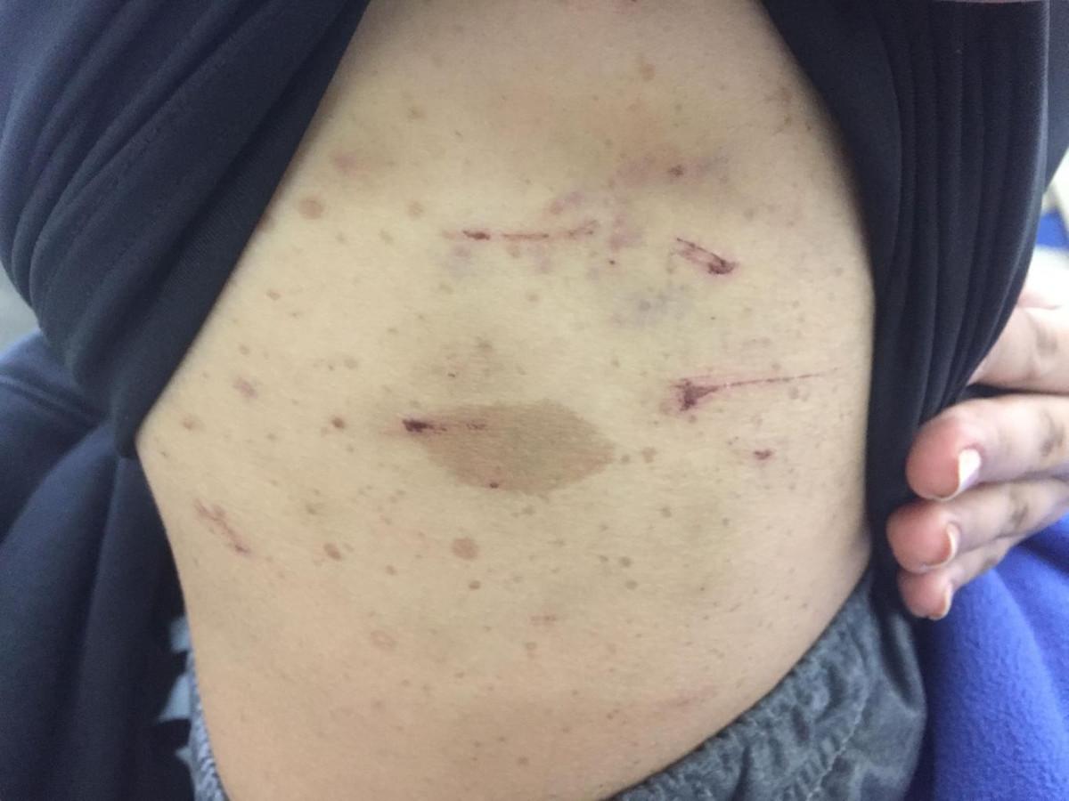 Loi ke dau don cua me thieu nu bi “trum dieu dao” tra tan da man