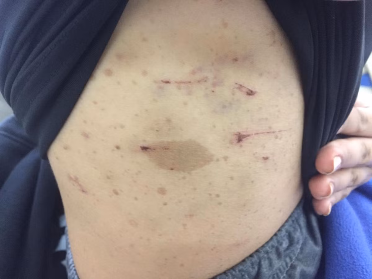 Loi ke dau don cua me thieu nu bi “trum dieu dao” tra tan da man