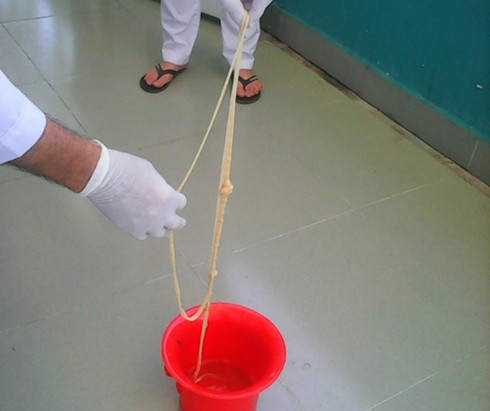 Kinh hai san xo mit dai 7m lam to trong bung nguoi dan ong o Quang Nam