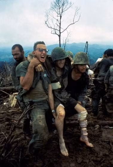 Gương mặt lộ rõ sự đau đớn của lính Mỹ bị thương trong cuộc giao tranh ác liệt tại chiến trường Việt Nam.