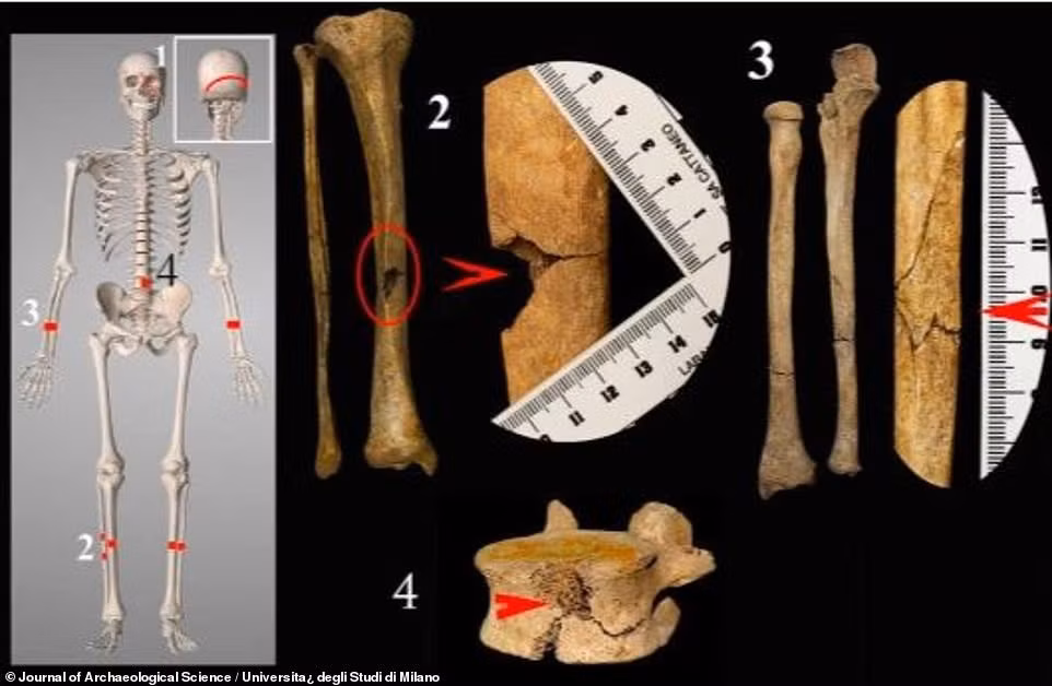 Mới đây, các nhà khảo cổ thông báo tìm thấy một bộ hài cốt có niên đại vào thế kỷ 13. Những dấu vết trên xương hé lộ người đàn ông này tử vong do bị hành hình bởi quái chiêu tra tấn rùng rợn.