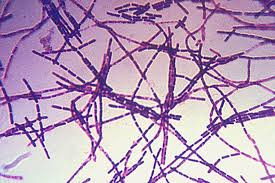 Vào năm 2001, một số bức thư chứa bào tử bệnh than được chuyển tới một số cơ quan truyền thông và văn phòng của hai thượng nghị sĩ Mỹ. Hậu quả là 5 người chết và 17 người nhiễm bệnh.