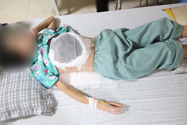 Thay hach o nach, dau hieu ung thu di can ma khong biet