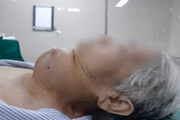 Tế bào ung thư sinh sôi suốt 50 năm trên cổ người phụ nữ Te bao ung thu sinh soi suot 50 nam tren co nguoi phu nu