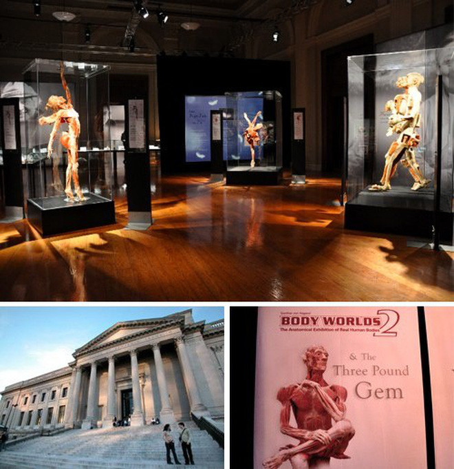 Ông Hagens tổ chức một số buổi triển lãm mẫu vật cơ thể người thật đã được nhựa hóa với mục đích giúp khách tham quan hiểu rõ cơ thể người.